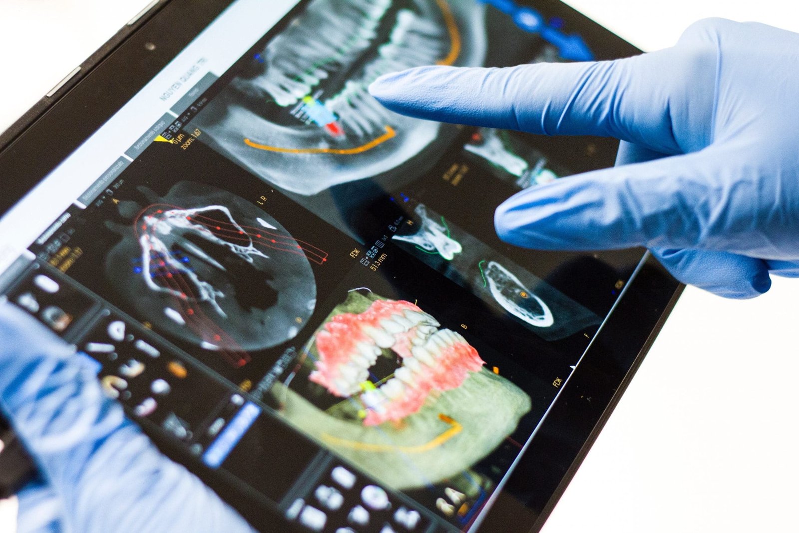 moderen Implantate in Linz